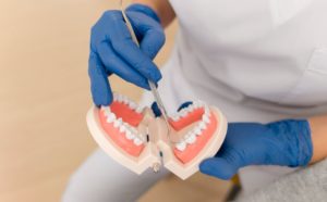 dental assistant training academy-teeth-model